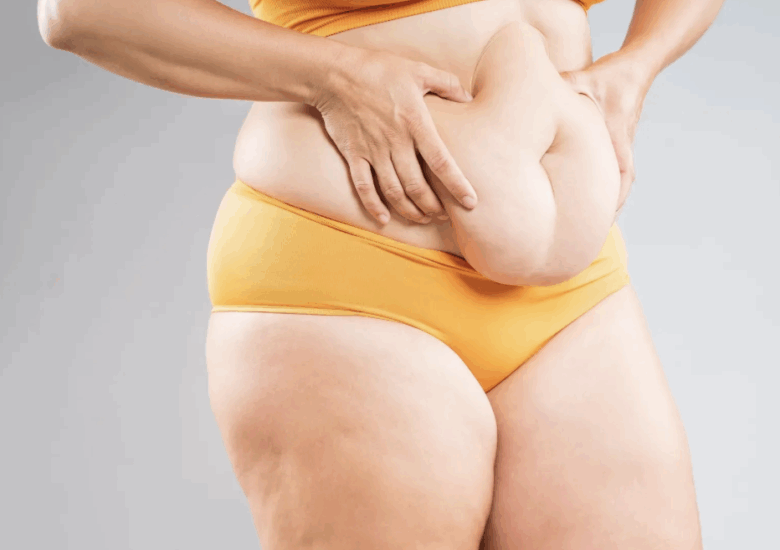 Weight Gain After Breast Cancer: Hormones, GLP-1s & Real Talk on Survivorship